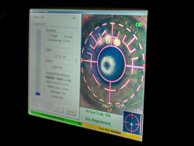 Badanie oka w trakcie laserowej korekcji